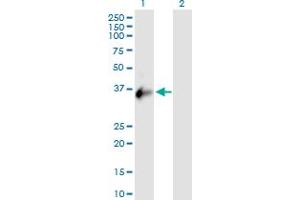 Western Blot analysis of CXorf21 expression in transfected 293T cell line by CXorf21 MaxPab polyclonal antibody. (CXorf21 antibody  (AA 1-301))