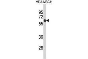 Western blot analysis of ANKRD13C Antibody (N-term) in MDA-MB231 cell line lysates (35µg/lane). (ANKRD13C antibody  (N-Term))