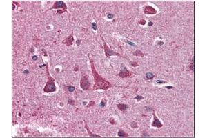 Immunohistochemistry (IHC) image for anti-14-3-3 theta (YWHAQ) (AA 1-245), (N-Term) antibody (ABIN336110) (14-3-3 theta antibody  (N-Term))