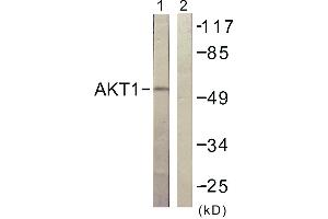 Immunohistochemistry analysis of paraffin-embedded human skeletal muscle tissue using Akt (Ab-129) antibody.