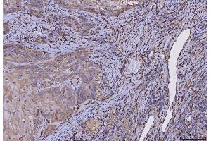 IHC analysis of HLA-DRA using anti-HLA-DRA antibody (ABIN7600949). (HLA-DRA antibody  (AA 26-254))