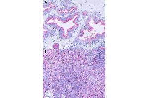 Immunohistochemical staining of formalin-fixed paraffin-embedded human prostate (A) and human spleen (B) with GPR63 polyclonal antibody . (GPR63 antibody  (Extracellular Domain))