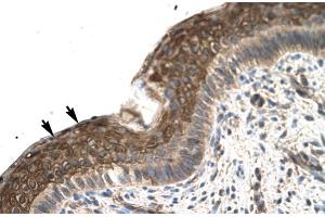 Rabbit Anti-ZFP1 Antibody Catalog Number: ARP31586 Paraffin Embedded Tissue: Human Spermatophore Cellular Data: Epithelial cells Antibody Concentration: 4. (Zfp-1 antibody  (N-Term))