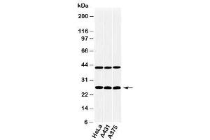 Western blot testing of human samples with CLEC4E antibody at 2ug/ml. (CLEC4E antibody  (C-Term))