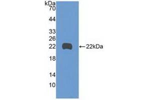 Western blot analysis of recombinant Human GADD45b. (GADD45B antibody  (AA 1-160))