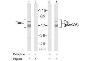 Image no. 2 for anti-Microtubule-Associated Protein tau (MAPT) (Ser396) antibody (ABIN197256)