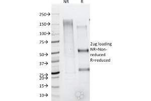 SDS-PAGE Analysis Purified CD79b Mouse Monoclonal Antibody (IGB/1844).