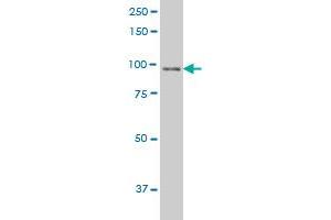 NBN monoclonal antibody (M01), clone 3E4 Western Blot analysis of NBN expression in COLO 320 HSR . (Nibrin antibody  (AA 645-754))