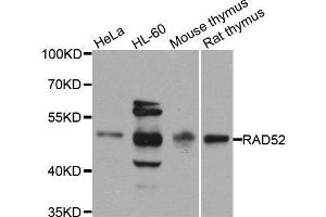 Western blot analysis of extracts of various cell lines, using RAD52 antibody. (RAD52 antibody  (AA 125-418))