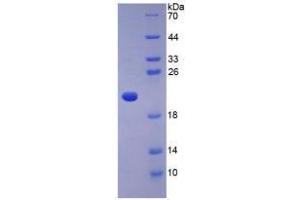 SDS-PAGE analysis of Human Adiponectin Protein. (ADIPOQ Protein)