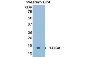 Western Blotting (WB) image for anti-V-Set Domain Containing T Cell Activation Inhibitor 1 (VTCN1) (AA 34-147) antibody (ABIN3201798) (VTCN1 antibody  (AA 34-147))