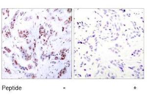 Image no. 2 for anti-Myocyte Enhancer Factor 2A (MEF2A) (Thr312) antibody (ABIN197165) (MEF2A antibody  (Thr312))