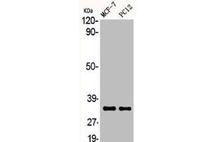 Western Blot analysis of MCF7 PC-12 cells using ACOT8 Polyclonal Antibody