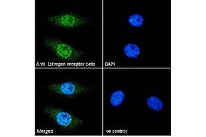 ABIN5539801 Immunofluorescence analysis of paraformaldehyde fixed HeLa cells, permeabilized with 0. (ESR2 antibody  (AA 417-428))