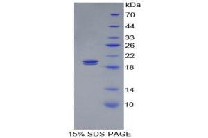 SDS-PAGE (SDS) image for Glycophorin A (GYPA) (AA 1-108) protein (His tag) (ABIN2125043)
