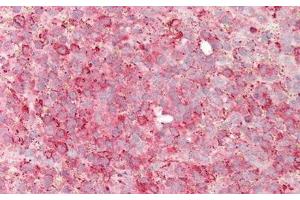 Immunohistochemistry (IHC) image for anti-Nuclear Factor of kappa Light Polypeptide Gene Enhancer in B-Cells 2 (NFKB2) (AA 38-343) antibody (ABIN7437092)