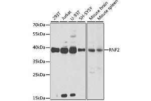 Western blot analysis of extracts of various cell lines, using RNF2 antibody. (RNF2 antibody  (AA 1-336))