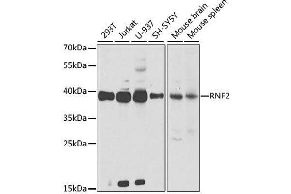 RNF2 antibody  (AA 1-336)