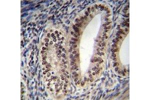 Progesterone Receptor antibody immunohistochemistry analysis in formalin fixed and paraffin embedded human uterus tissue. (Progesterone Receptor antibody  (AA 349-377))