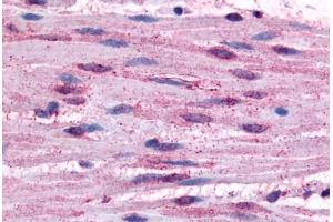 Human Smooth Muscle Cells (formalin-fixed, paraffin-embedded) stained with ADRA1B antibody ABIN213528 at 10 ug/ml followed by biotinylated goat anti-rabbit IgG secondary antibody ABIN481713, alkaline phosphatase-streptavidin and chromogen. (ADRA1B antibody  (Cytoplasmic Domain))