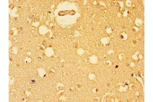 Immunohistochemistry of paraffin-embedded human brain tissue using ABIN7152184 at dilution of 1:100 (EIF4E antibody  (AA 2-217))