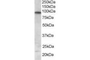 Image no. 1 for anti-Forkhead Box O3 (FOXO3) (C-Term) antibody (ABIN374440) (FOXO3 antibody  (C-Term))