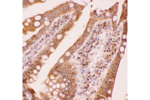 Immunohistochemistry (IHC) image for anti-Runt-Related Transcription Factor 1 (RUNX1) (AA 200-233), (Middle Region) antibody (ABIN3043318)