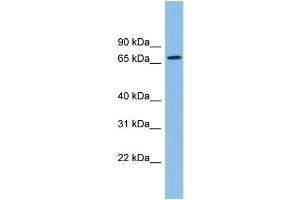 WB Suggested Anti-ZNF182 Antibody Titration: 0.