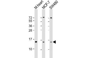 All lanes : Anti-NDUFA7 Antibody (C-Term) at 1:2000 dilution Lane 1: mouse heart lysate Lane 2: MCF-7 whole cell lysate Lane 3: S whole cell lysate Lysates/proteins at 20 μg per lane.