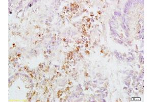 Immunohistochemistry (Paraffin-embedded Sections) (IHC (p)) image for anti-Integrin beta 3 (ITGB3) (AA 27-120) antibody (ABIN739029)