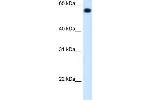 ALDH4A1 antibody used at 1. (ALDH4A1 antibody  (C-Term))