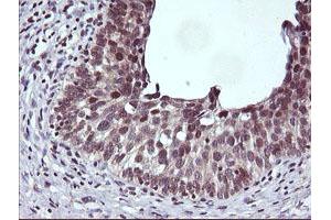 Image no. 1 for anti-Cancer/testis Antigen 1B (CTAG1B) antibody (ABIN1499894) (CTAG1B antibody)