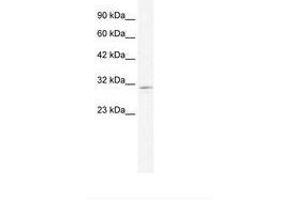 Image no. 1 for anti-Chloride Intracellular Channel 2 (CLIC2) (AA 162-211) antibody (ABIN202119)
