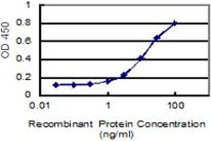 Detection limit for recombinant GST tagged KIAA1217 is 0. (ETL4 antibody  (AA 1-877))