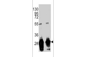 Western blot analysis of anti-GFP Tag Antibody (Ascites) (CA071114E) in GFP recombinant protein. (GFP Tag antibody)