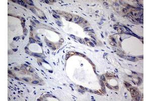 Image no. 1 for anti-TIA1 Cytotoxic Granule-Associated RNA Binding Protein (TIA1) antibody (ABIN1501387) (TIA1 antibody)