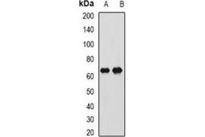 Western blot analysis of CTNNBL1 expression in Hela (A), SW620 (B) whole cell lysates. (CTNNBL1 antibody)