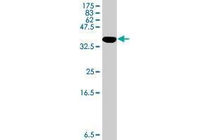 Western Blot detection against Immunogen (37. (TRIM32 antibody  (AA 105-204))