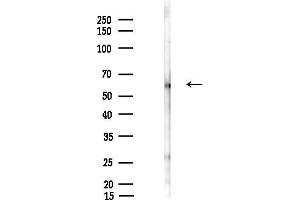 anti-Zinc Finger Protein 530 (ZNF530) antibody