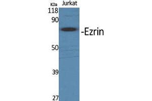 Western Blot (WB) analysis of specific cells using Ezrin Polyclonal Antibody. (Ezrin antibody  (Tyr315))