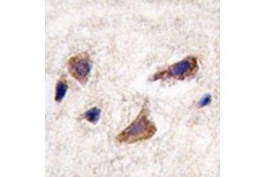 IHC analysis of FFPE human brain tissue stained with CAMKK2 antibody (CAMKK2 antibody  (AA 483-512))
