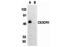 Western Blotting (WB) image for anti-Chemokine (C-X3-C Motif) Receptor 1 (CX3CR1) (Extracellular Loop) antibody (ABIN1030840) (CX3CR1 antibody  (Extracellular Loop))
