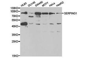 Western Blotting (WB) image for anti-Serpin Peptidase Inhibitor, Clade G (C1 Inhibitor), Member 1 (SERPING1) antibody (ABIN1874741)