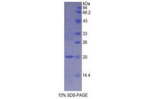 SDS-PAGE (SDS) image for Nitric Oxide Synthase 1, Neuronal (NOS1) (AA 726-894) protein (His tag) (ABIN2121772)