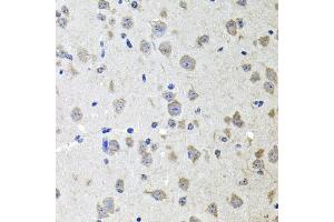 Immunohistochemistry of paraffin-embedded mouse brain using ALPL antibody (ABIN5970438) at dilution of 1/100 (40x lens). (ALPL antibody)