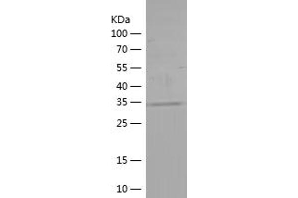 Ataxin 2 Protein (ATXN2) (AA 1-165) (His tag)