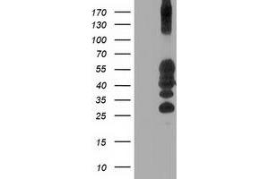 Western Blotting (WB) image for anti-Protein tyrosine Phosphatase, Non-Receptor Type 1 (PTPN1) antibody (ABIN1500497) (PTPN1 antibody)