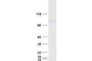 Western Blotting (WB) image for Tumor Protein P73 (TP73) (Transcript Variant 1) protein (Myc-DYKDDDDK Tag) (ABIN2734636)