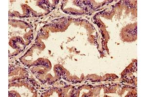 Immunohistochemistry of paraffin-embedded human prostate tissue using ABIN7145684 at dilution of 1:100 (BMP2 antibody  (AA 283-396))