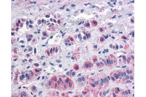 Anti-OX1R / Orexin Receptor 1 antibody IHC of human Adrenal, Pheochromocytoma. (HCRTR1 antibody  (C-Term))